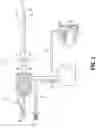 Fig. 02 - Catheter system for treating thromboembolic disease