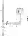 Fig. 09 - Catheter system for treating thromboembolic disease