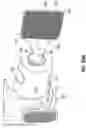 Fig. 28 - Catheter system for treating thromboembolic disease