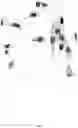 Fig. 03 - Detection and Treatment of Malignant Tumours in the CNS