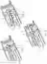 Fig. 06 - Medication delivery device with gear set dosage system