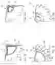 Fig. 09 - Medication delivery device with gear set dosage system