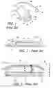 Fig. 02 - Cochlear implants, magnets for use with same and magnet retrofit methods