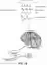 Fig. 04 - Systems Methods And Devices For Closed-Loop Stimulation To Enhance Stroke Recovery