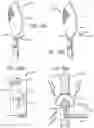 Fig. 35 - Electric lighting devices