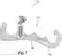 Fig. 09 - Archery release aid