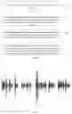 Fig. 02 - METHOD FOR PROCESSING SPEECH SIGNAL, ELECTRONIC DEVICE AND STORAGE MEDIUM