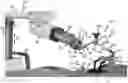 Fig. 01 - Robot-mounted retractor system