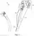 Fig. 02 - ENDOSCOPIC SUTURING DEVICE