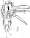 Fig. 09 - Surgical stapling instrument with an articulatable end effector