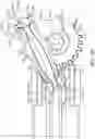 Fig. 124 - Surgical stapling instrument with an articulatable end effector