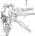 Fig. 79 - Surgical stapling instrument with an articulatable end effector