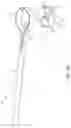 Fig. 02 - System for Articular Surface Replacement