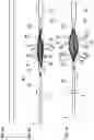Fig. 04 - Medical device and treatment method