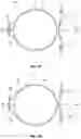 Fig. 08 - Modular intraocular lens designs, tools and methods