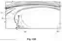 Fig. 16 - Modular intraocular lens designs, tools and methods