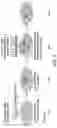 Fig. 07 - COMPOSITE LIGHT ADJUSTABLE INTRAOCULAR LENS WITH ADHESION PROMOTER