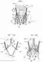 Fig. 02 - Sinus-engaging valve fixation member
