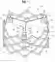 Fig. 02 - Prosthetic valve