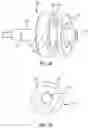 Fig. 24 - Delivery system for heart valve replacement