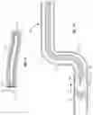 Fig. 35 - Delivery system for heart valve replacement