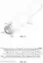 Fig. 09 - Methods and systems for treatment of aneurysms