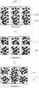 Fig. 05 - MULTI-LAYERED NON-WOVEN STRUCTURE FOR USE AS A COMPONENT OF DISPOSABLE ABSORBENT ARTICLES