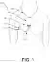Fig. 02 - SIMULATED FLOW-CONTROL BREAST FEEDING SYSTEM