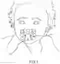 Fig. 02 - PACIFIER COVER AND TEETHER
