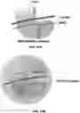Fig. 30 - NANOCAPSULES FOR THE DELIVERY OF CELL MODULATING AGENTS