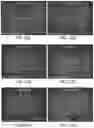 Fig. 20 - Methods for development and use of minimally polarized function cell micro-aggregate units in tissue applications using LGR4, LGR5 and LGR6 expressing epithelial stem cells
