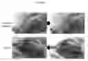 Fig. 03 - INJECTABLE HYDROGELS FOR LOCAL DELIVERY TO THE HEART