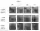 Fig. 04 - INJECTABLE HYDROGELS FOR LOCAL DELIVERY TO THE HEART