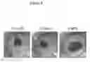Fig. 05 - INJECTABLE HYDROGELS FOR LOCAL DELIVERY TO THE HEART