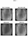 Fig. 10 - INJECTABLE HYDROGELS FOR LOCAL DELIVERY TO THE HEART