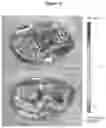 Fig. 13 - INJECTABLE HYDROGELS FOR LOCAL DELIVERY TO THE HEART