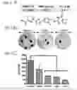 Fig. 02 - COMPOUNDS AND METHODS FOR INHIBITION OF MULTIPLE MYELOMA