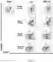 Fig. 13 - Process for generating genetically engineered autologous T cells