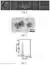 Fig. 02 - Method of making exosomes from tumor cell/antigen presenting cell hybrid cells