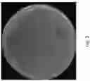 Fig. 04 - Recombinant Microorganism for Producing 2,3-Butanediol and a Method of Production of 2,3-Butanediol