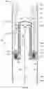 Fig. 02 - Sand accumulators to aid downhole pump operations