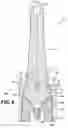 Fig. 07 - STUDDED BALL JOINT