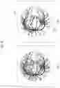 Fig. 49 - Method and device for assisting heart disease diagnosis