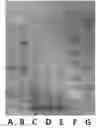 Fig. 01 - FERMENTED SOYBEAN MEAL AND PREPARATION METHOD THEREFOR