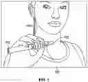 Fig. 02 - Cartridge Sleeve