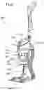 Fig. 09 - Portable surface cleaning apparatus