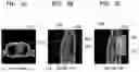 Fig. 07 - MEDICAL IMAGING APPARATUS AND MEDICAL IMAGING PROCESSING METHOD