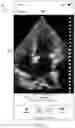 Fig. 09 - METHODS AND APPARATUSES FOR ENHANCING ULTRASOUND DATA