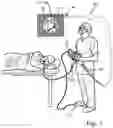 Fig. 02 - BIOPSY INSTRUMENTS AND METHODS