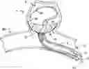 Fig. 01 - ANEURYSM OCCLUSION DEVICE